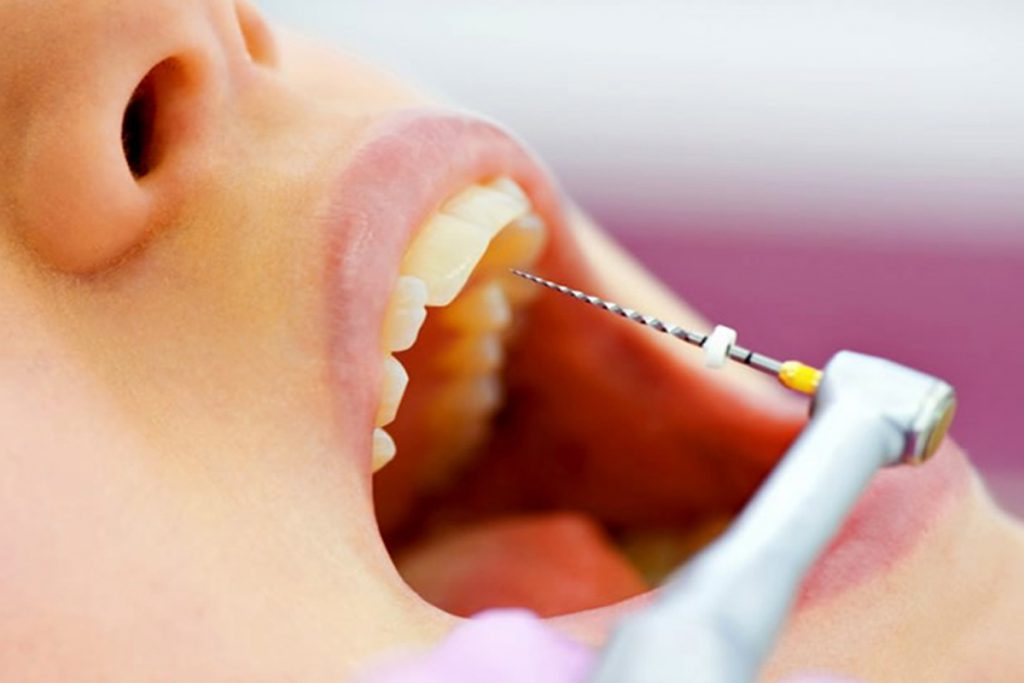 endodontia-1