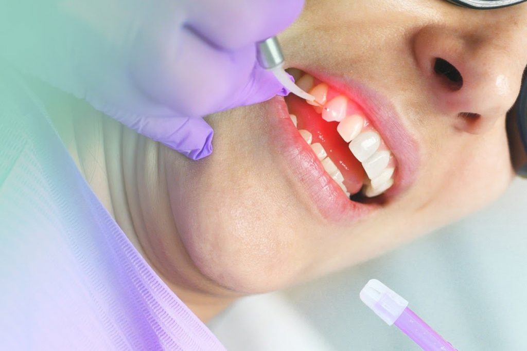 laserterapia-1