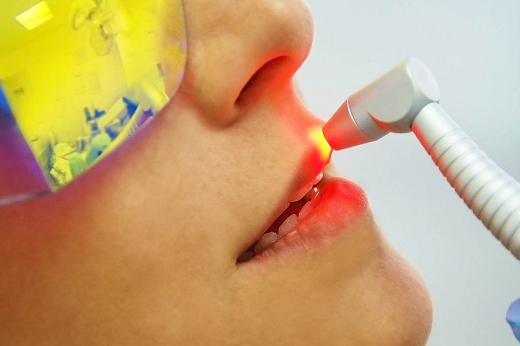 laserterapia-2
