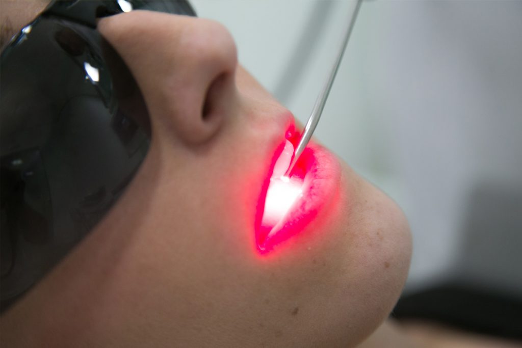 laserterapia-3