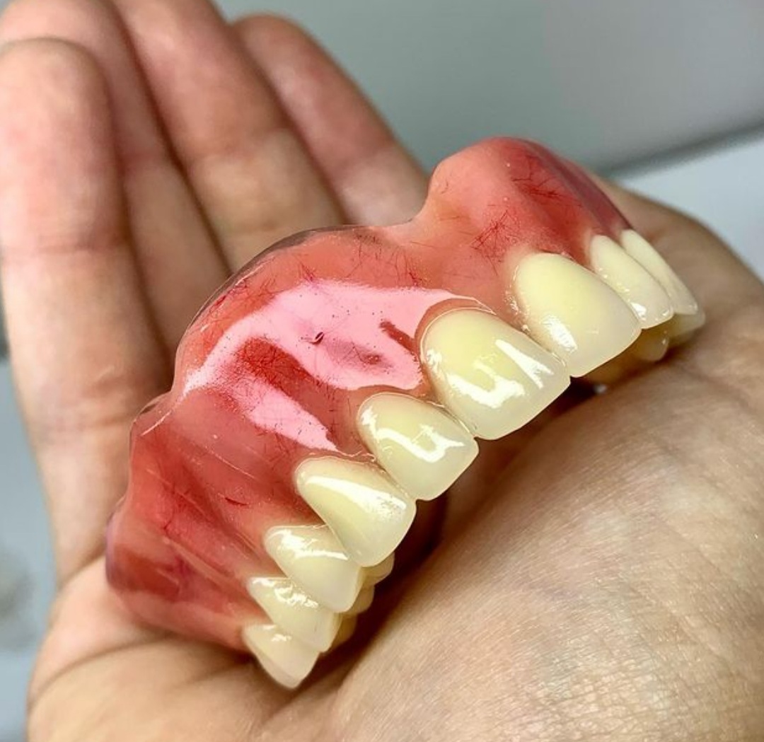 protese-dentaria-1