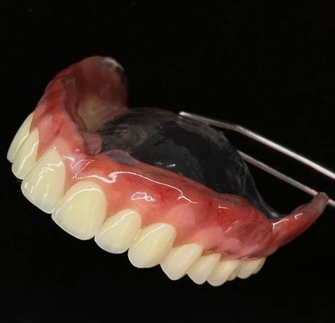 protese-dentaria-2